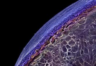 Wie sieht eine Wassermelonenzelle unter dem Mikroskop aus?